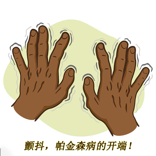 顫抖，帕金森病的開端 帕金森的早期癥狀